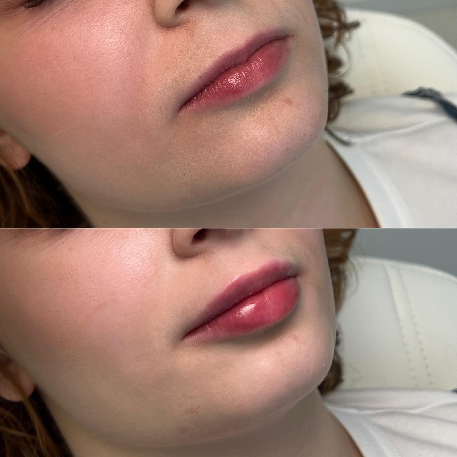 stymulatory-tkankowe