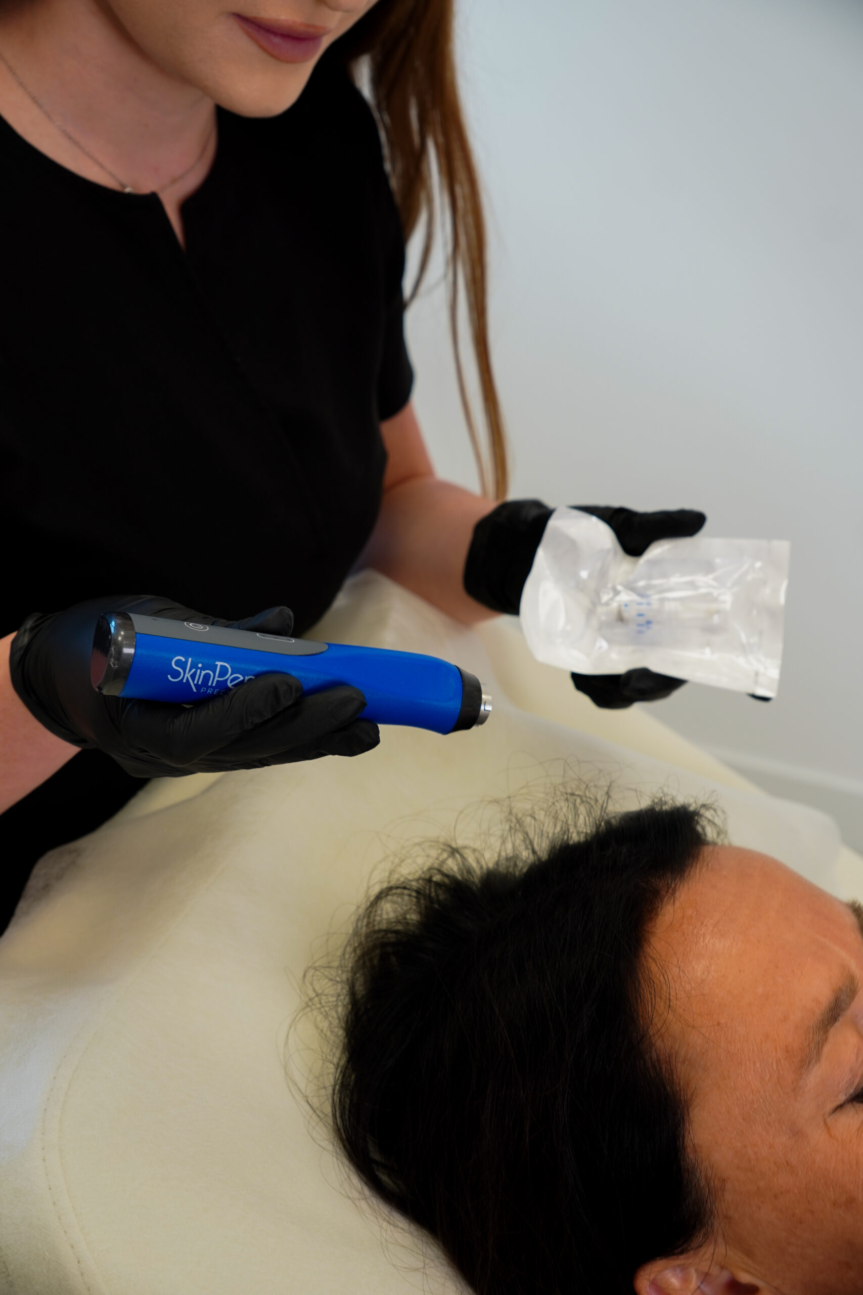 20260723-DSC00592 mezoterapia mikroigłowa